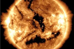 10-11coronal